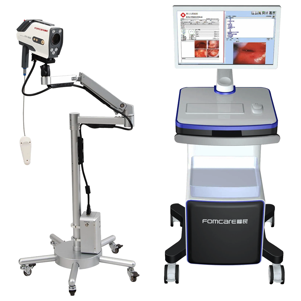 Digital HD Endoscopic Camera Colposcope with Vaginal Software