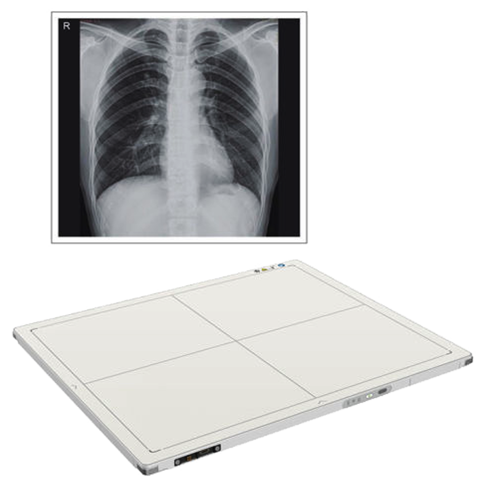 Digital X-Ray Flat Panel Detector