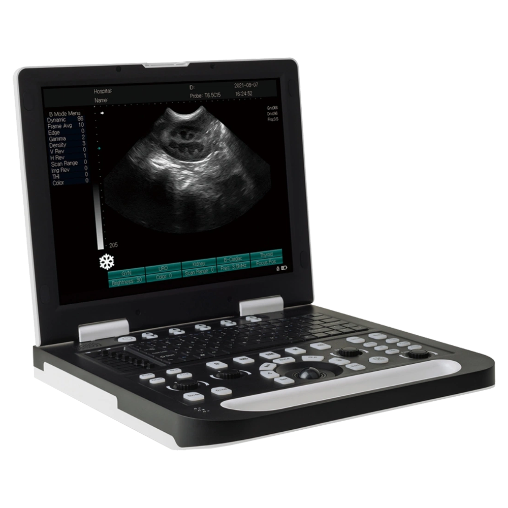 Full Digital Laptop B/W Ultrasound Scanner