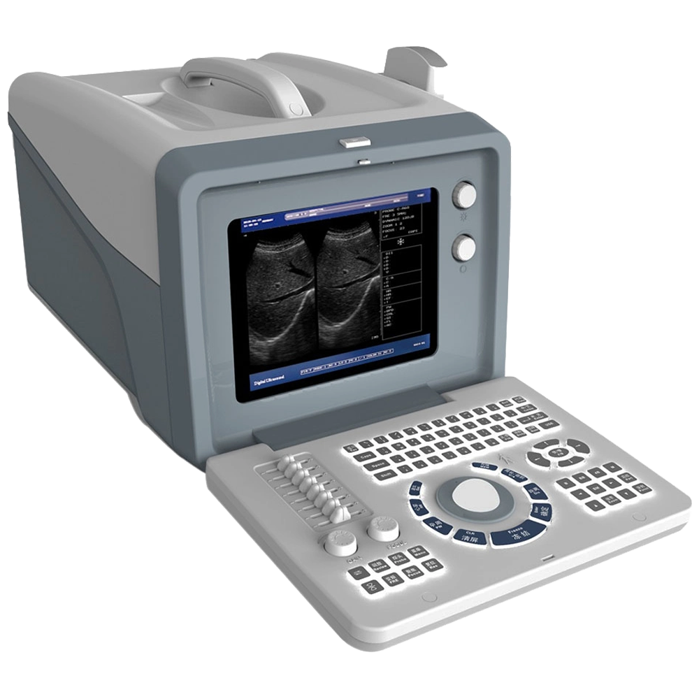 HBW 2 Medical Portable Full Digital B/W Ultrasound Scanner