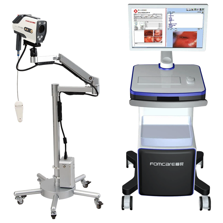 HD endoscopic camera colposcope