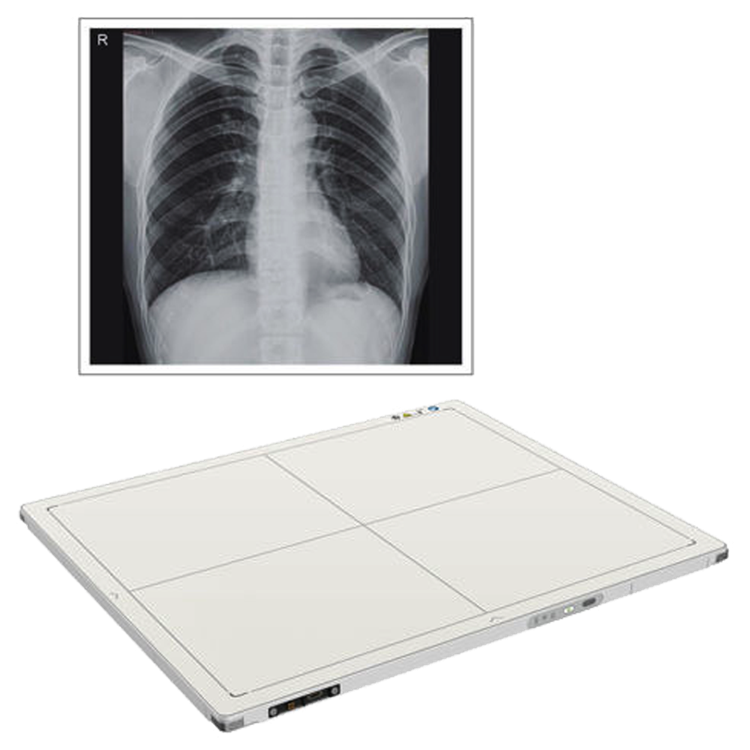Digital X ray flat panel detector