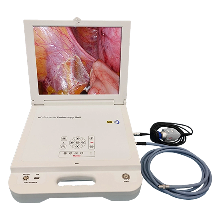 Portable ENT endoscope camera