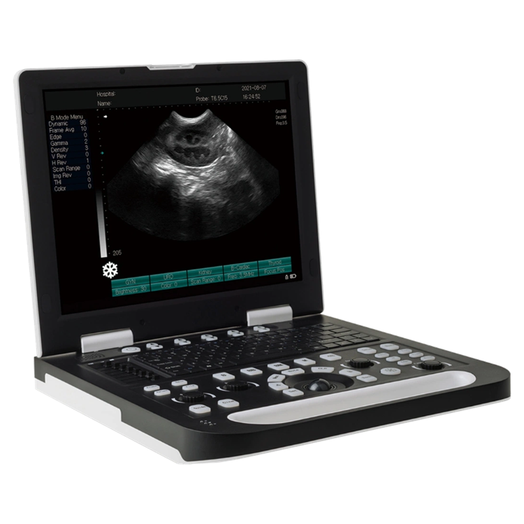 Laptop B/W ultrasound scanner