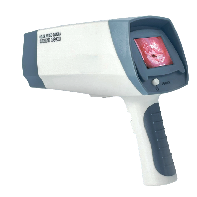 Digital optical colposcope machine