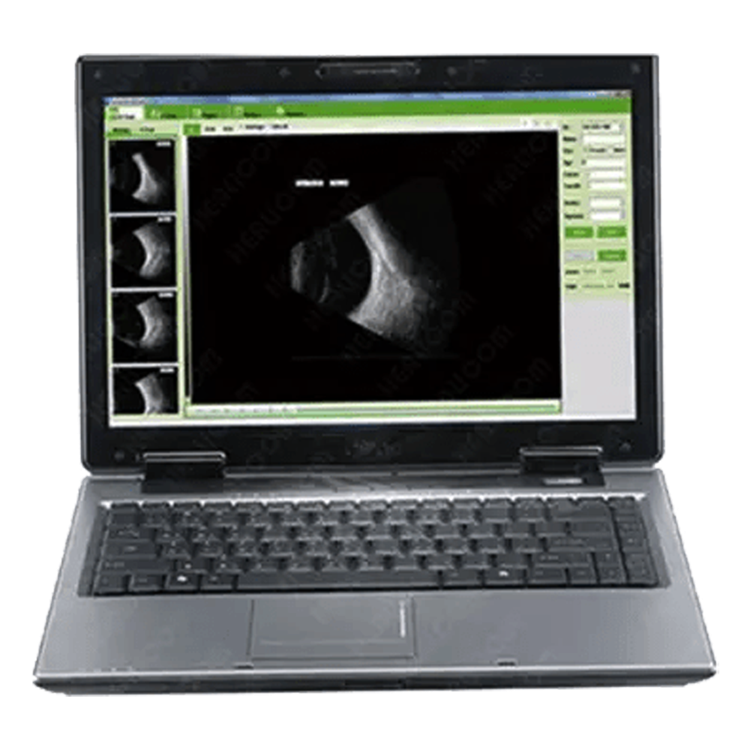 Ophthalmic A/B scanner
