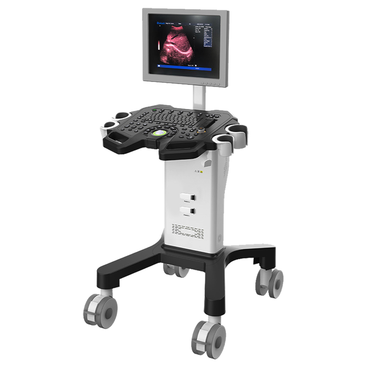 Digital trolley ultrasound scanner